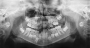 Pediatric Dentist - X-ray
